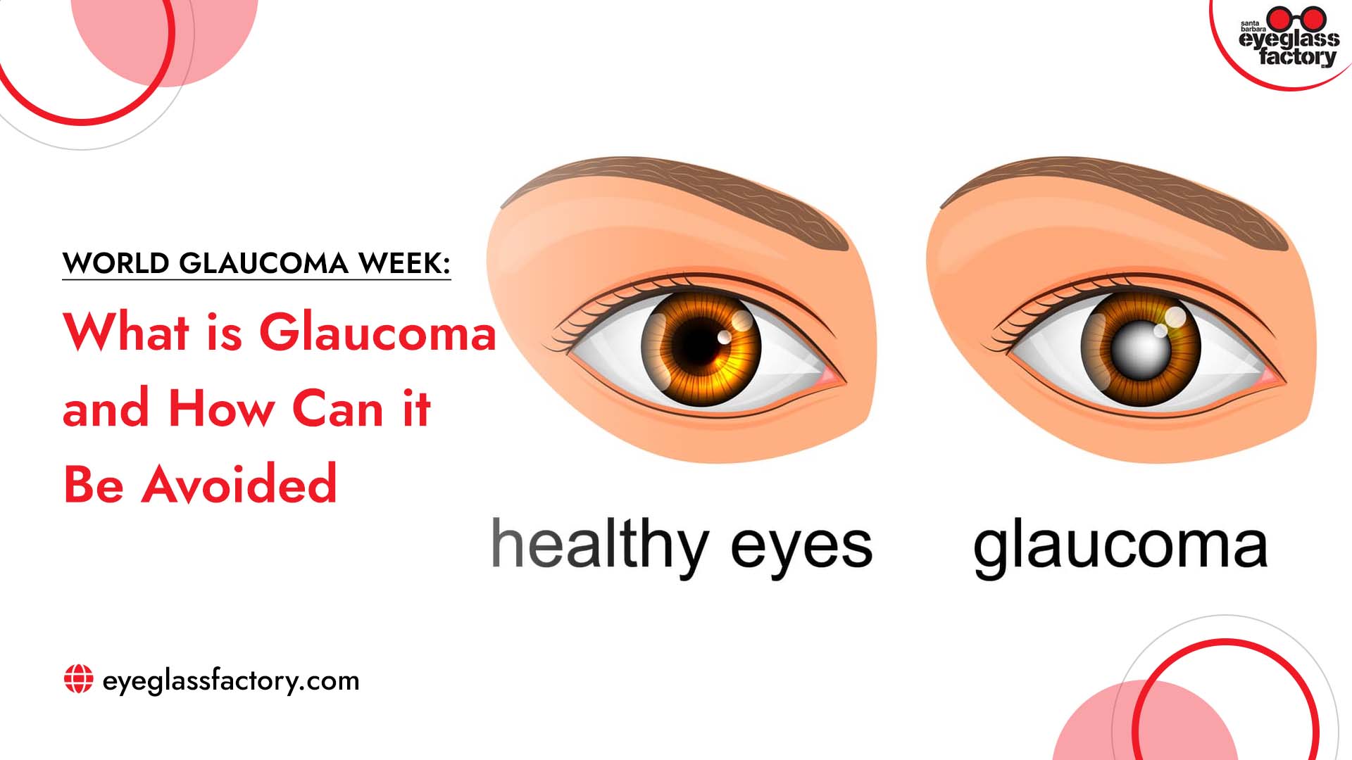 What is Glaucoma and How Can it Be Avoided