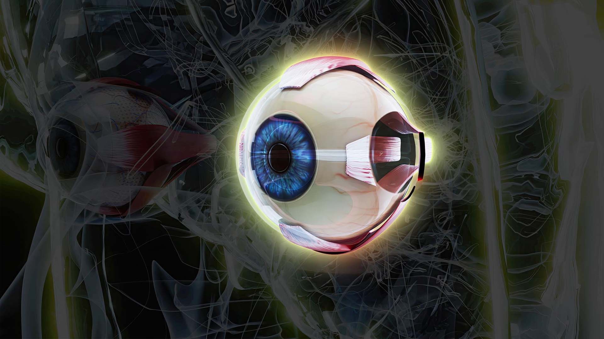 Glaucoma