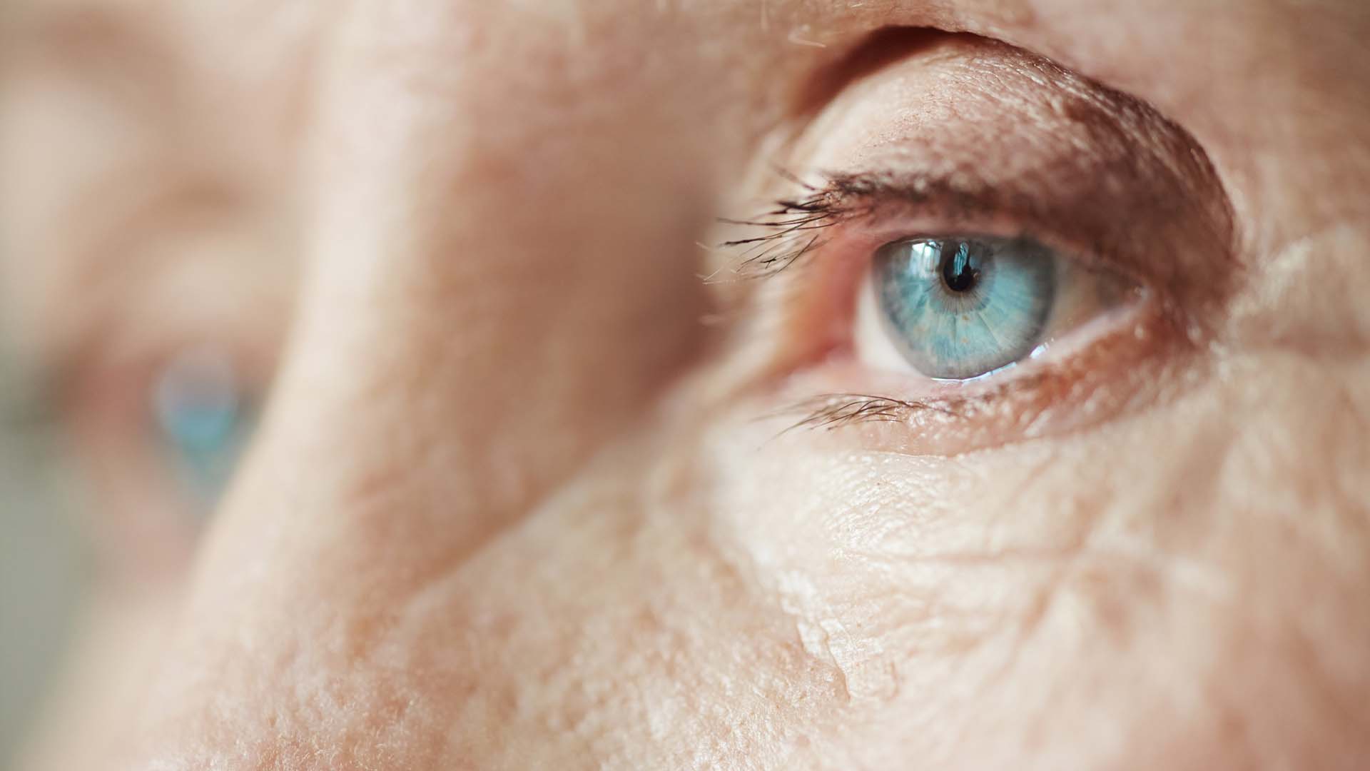 Retinal Detachment