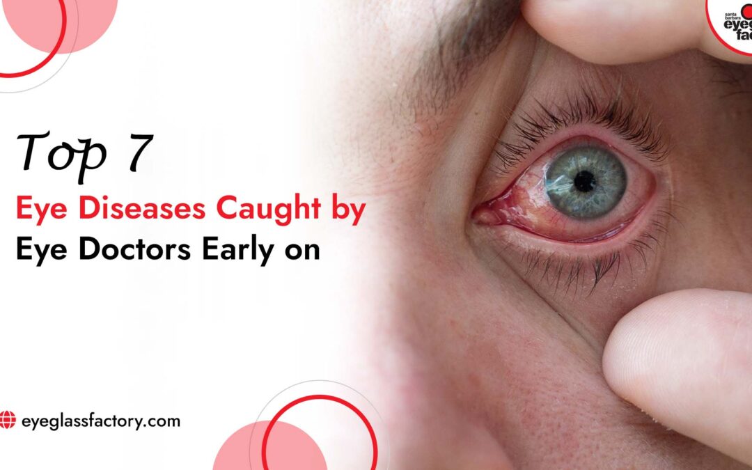 Top 7 Eye Diseases Caught by Eye Doctors Early on