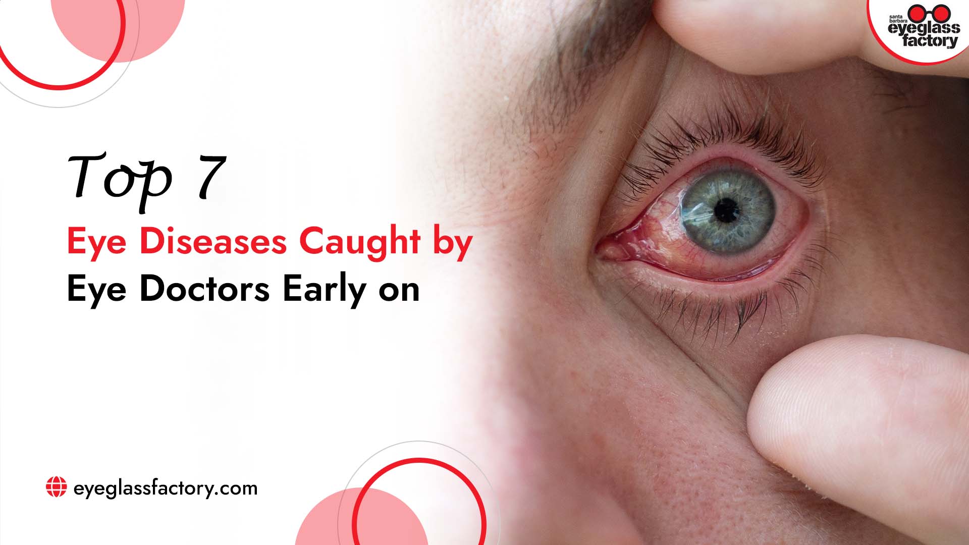 Top 7 Eye Diseases Eye Doctors Detect Early