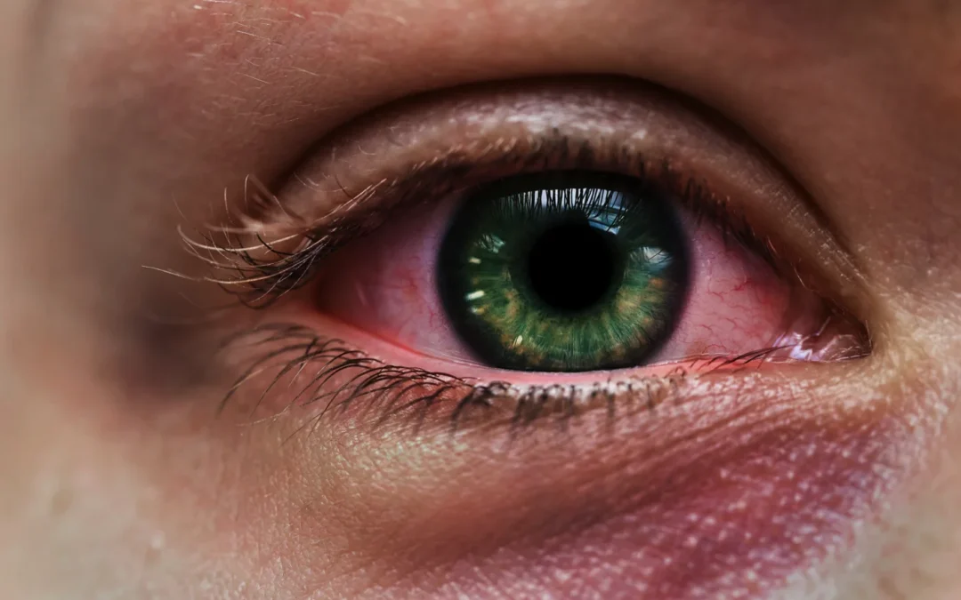 Top 7 Eye Diseases Caught by Eye Doctors Early on