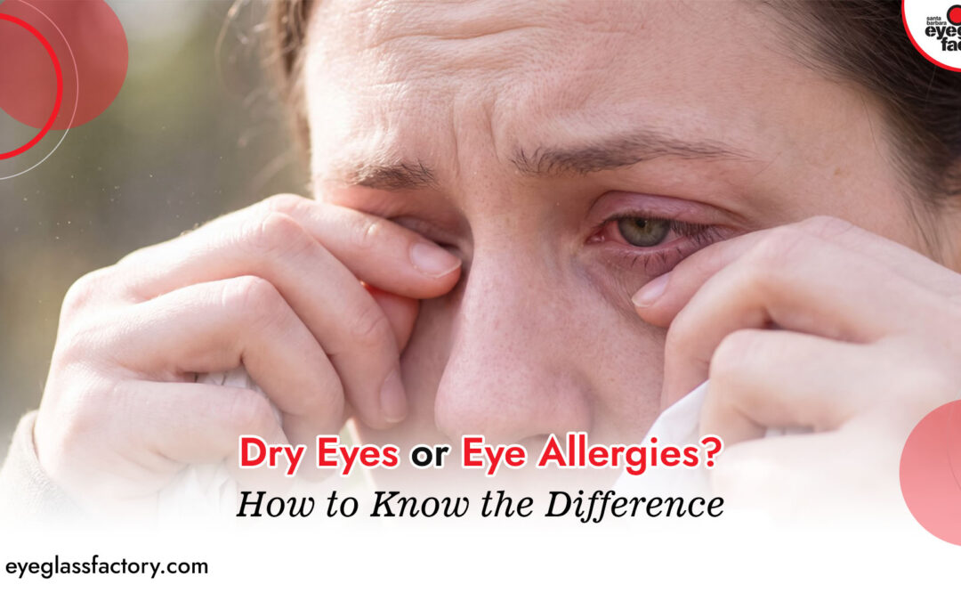 Dry Eyes or Eye Allergies? How to Know the Difference