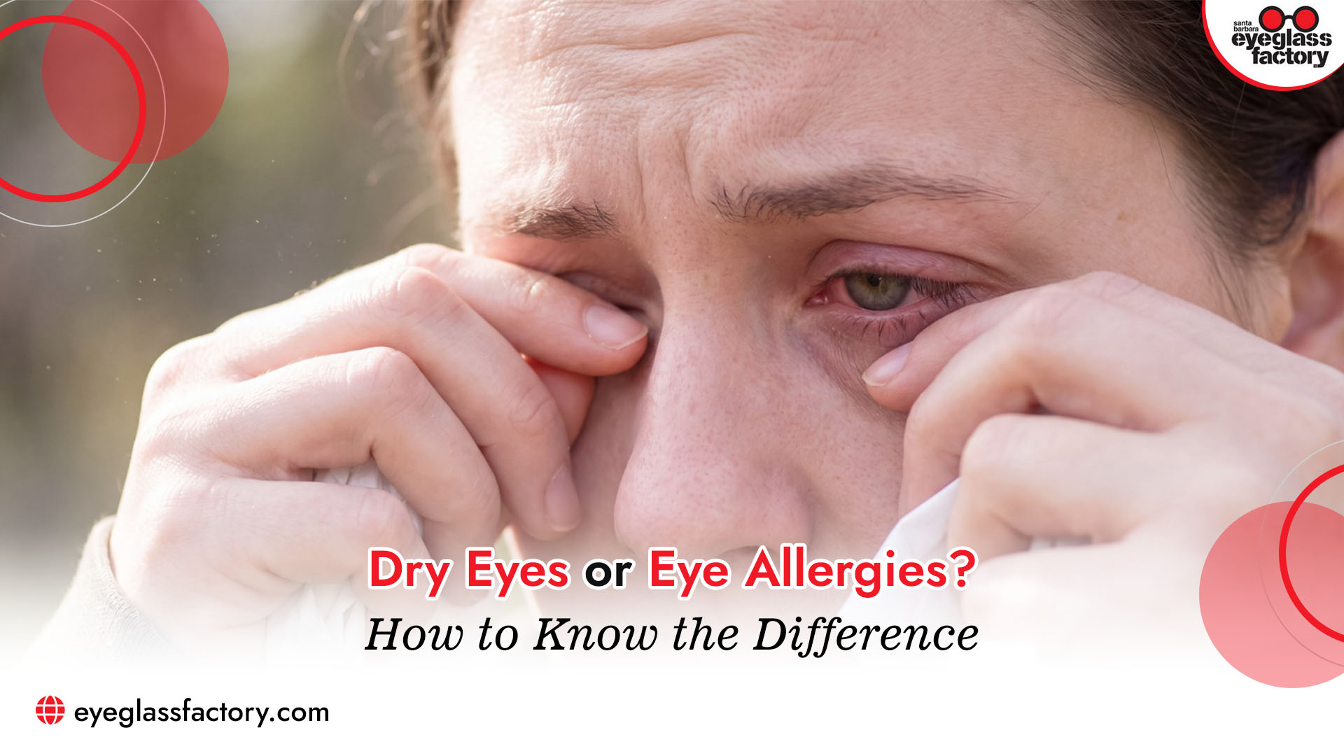 Eye Allergies Eye Allergies